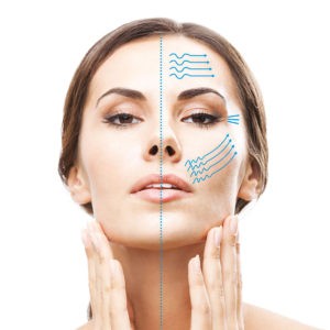 3D-Lipo HIFU Skin Tightening non surgical face lift 